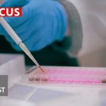 AI Cancer Warnings Years Early—Who Profits